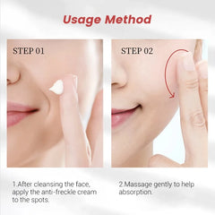Effective Freckle Cream Fast Brighten Face Remove Melasma Dark Spot Fade Melanin Whiten Anti-pigmentation Improve Dullness