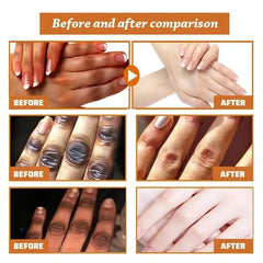 Fast Whitening Dark Knuckles Brighten Hand Cream Melanin Corrector Moisturizing Intense Stains Remover Cosmetics Skin Care 2024