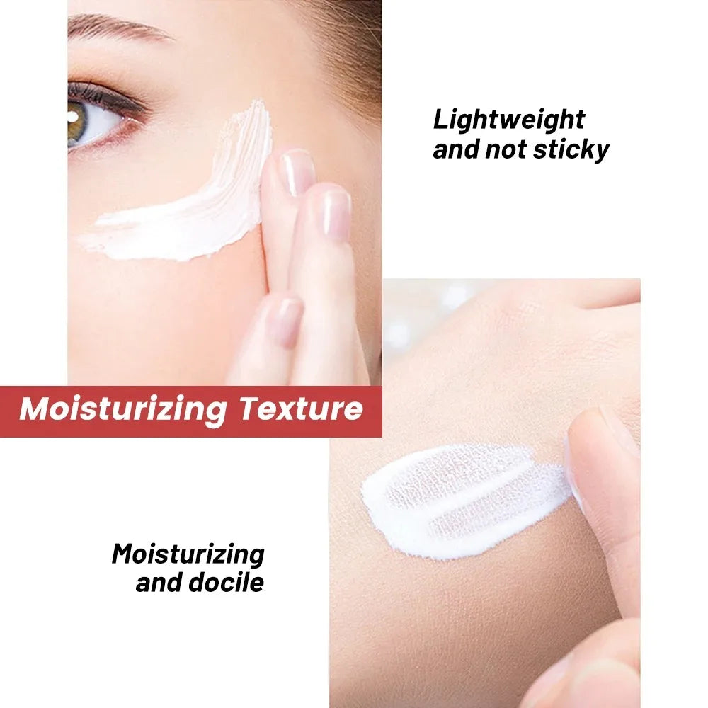 Effective Freckle Cream Fast Brighten Face Remove Melasma Dark Spot Fade Melanin Whiten Anti-pigmentation Improve Dullness