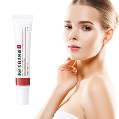 Effective Freckle Cream Fast Brighten Face Remove Melasma Dark Spot Fade Melanin Whiten Anti-pigmentation Improve Dullness